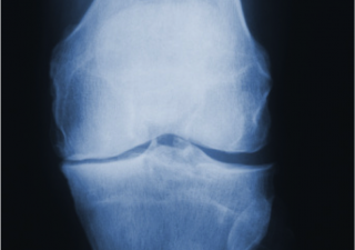 DePuy Synthes
